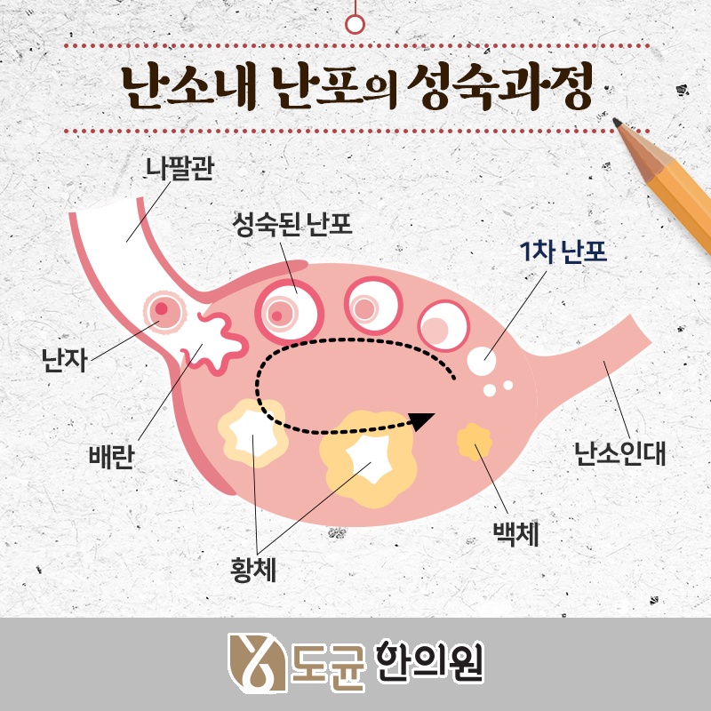 다낭성난소증후군이 여성 건강에 미치는 영향 살펴보기