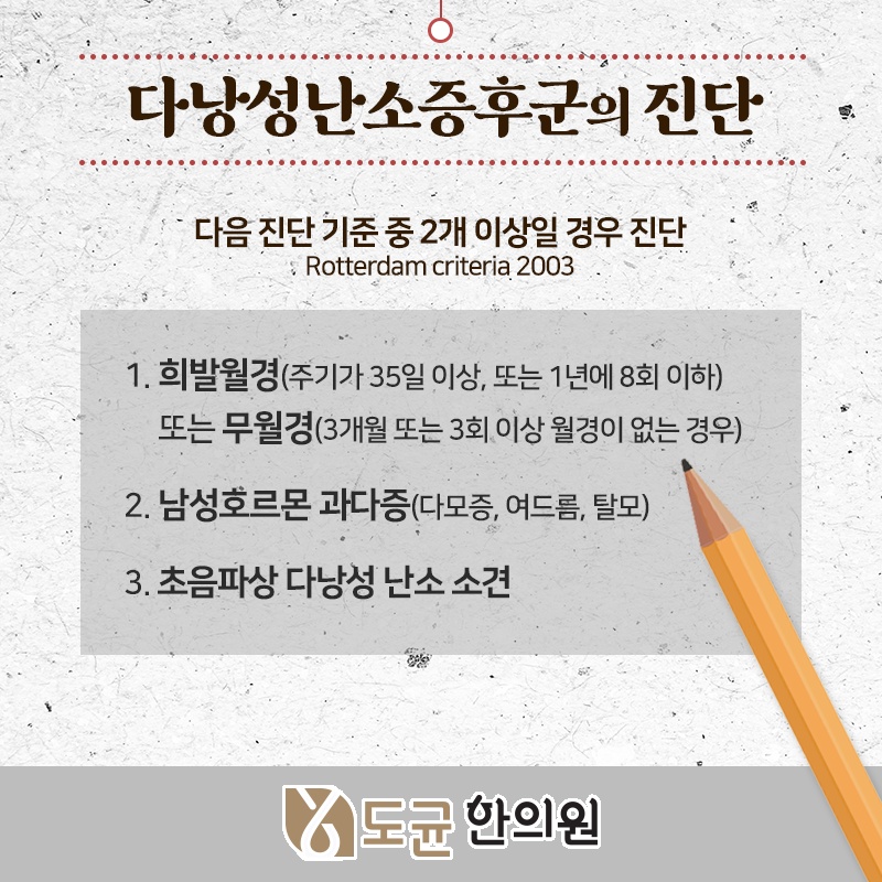 다낭성난소증후군이 여성 건강에 미치는 영향 살펴보기