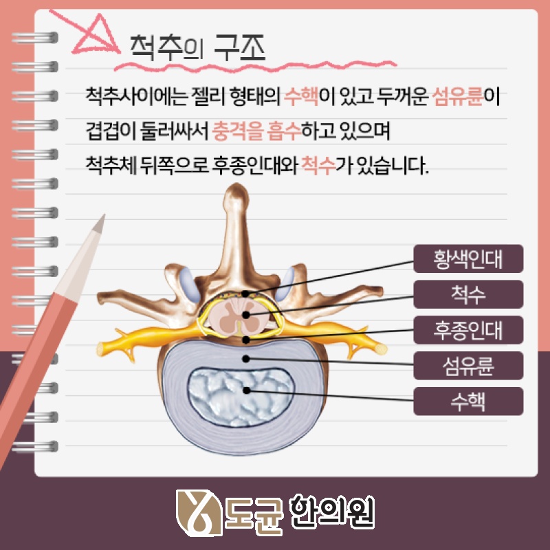 걸을 때 나타나는 허리디스크 하지 방사통의 특징