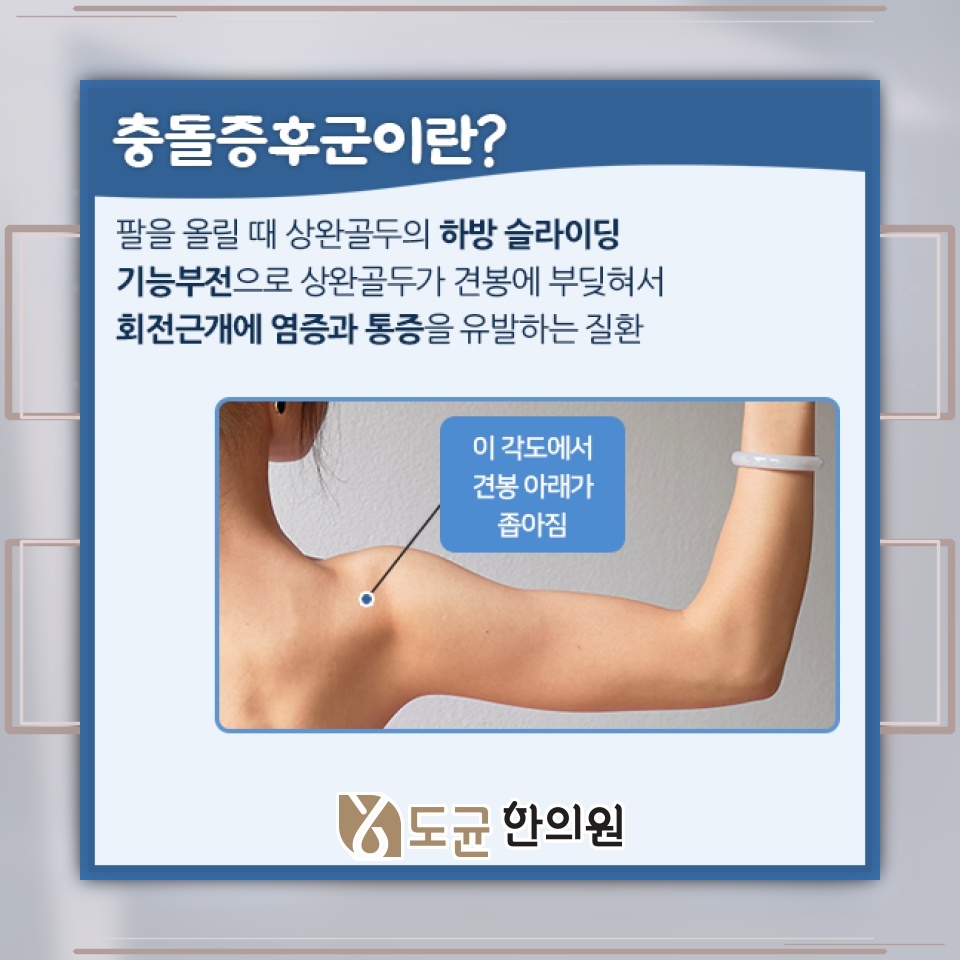 어깨 움직임을 방해하는 근육과 인대 손상, 충돌증후군