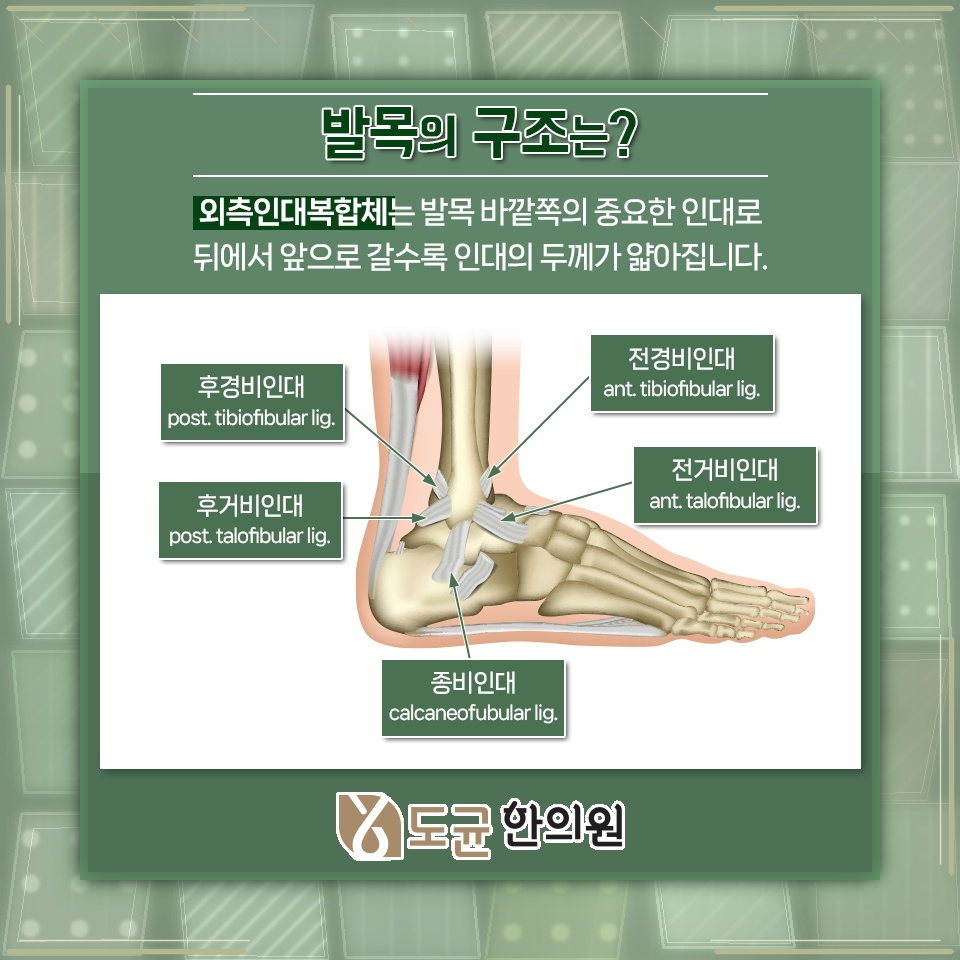 발목염좌가 발목 불안정증으로 이어지지 않게 살피는 방법
