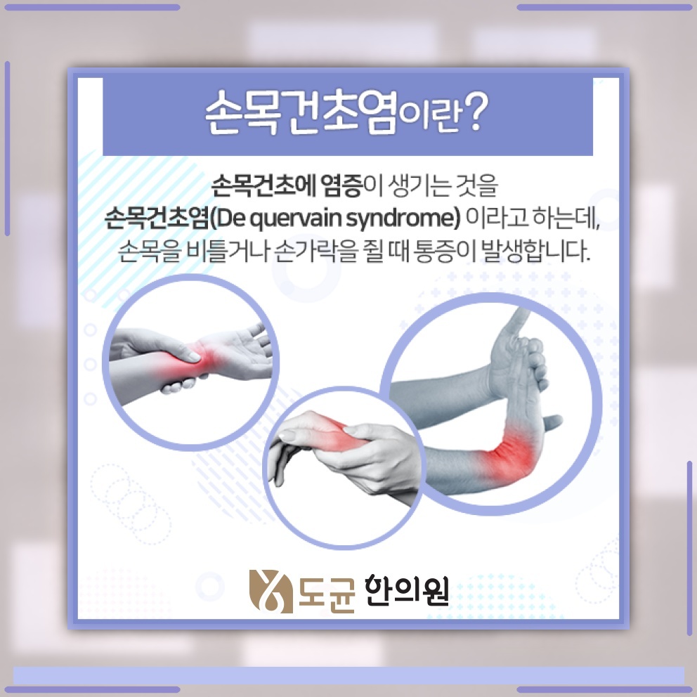 손목건초염, 작업 중 틈틈이 손목을 쉬게 하는 습관