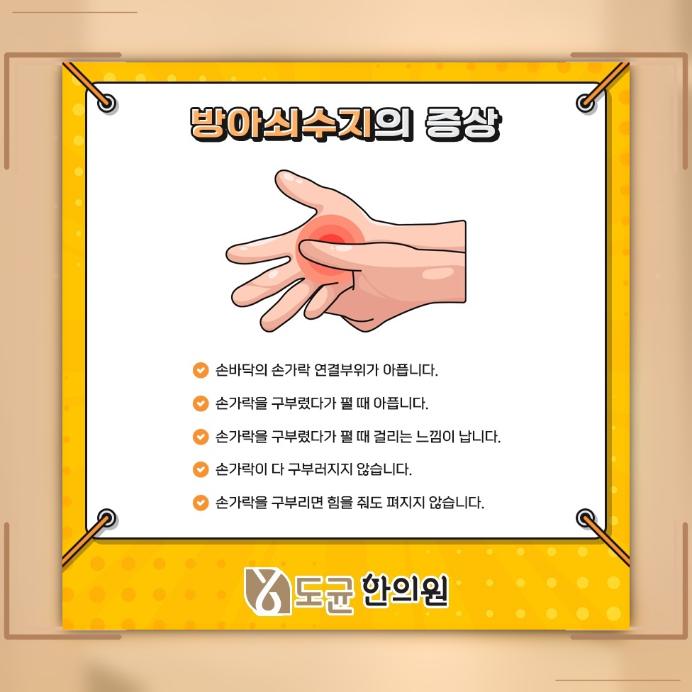 손가락이 붓고 아픈 방아쇠수지, 증상과 관리 방향