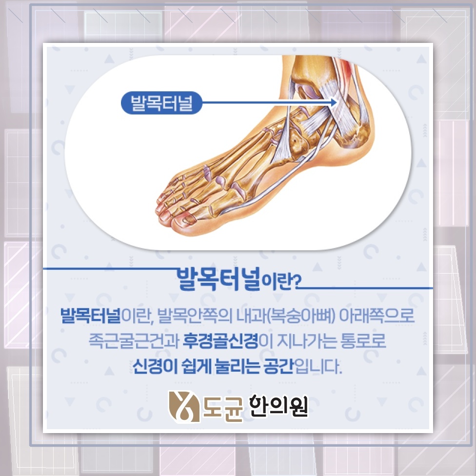 발목터널증후군에서 살펴볼 종아리와 발의 감각 이상