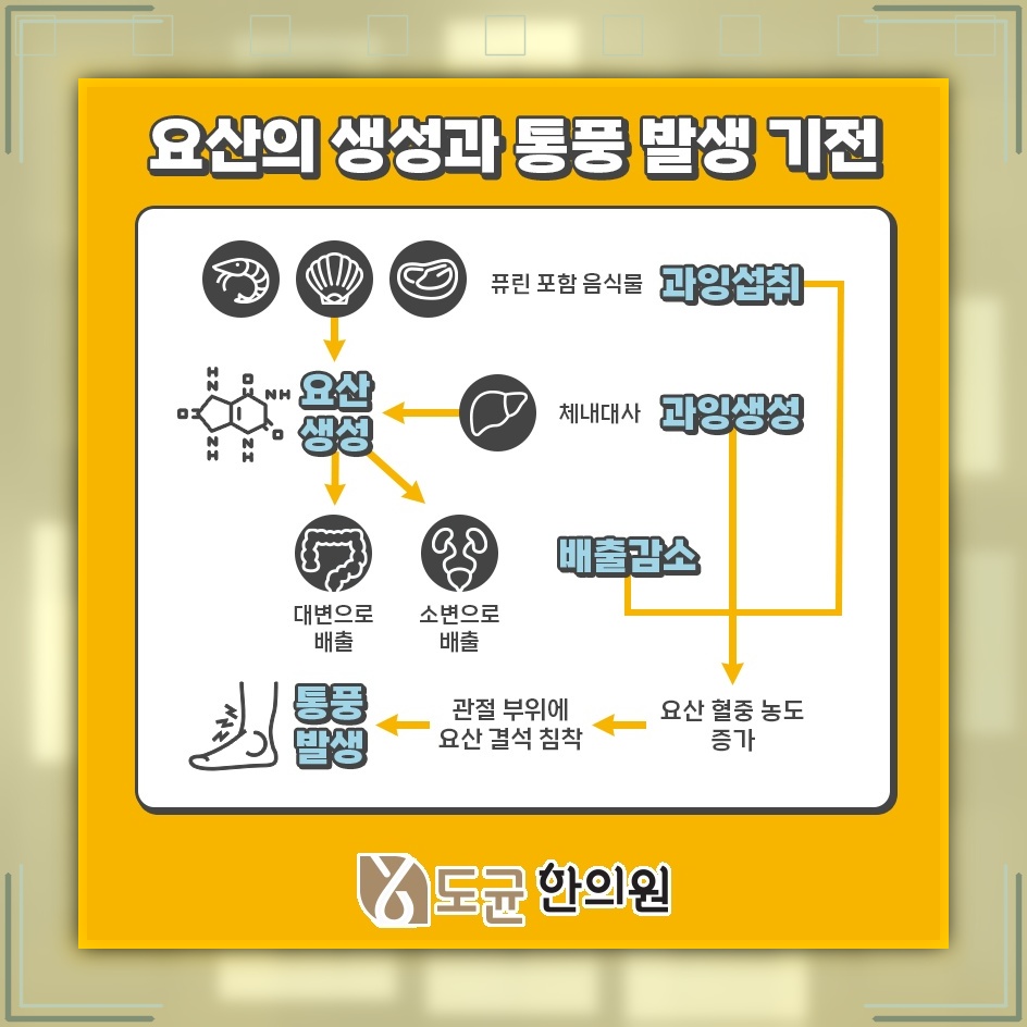 통풍 발작에 대비하는 초기 대응과 식사 관리 습관
