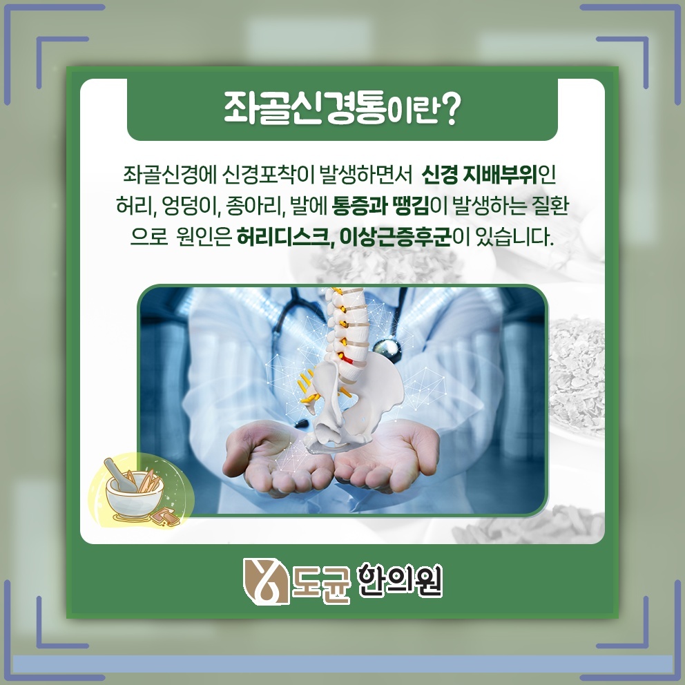 엉덩이 저림으로 오래 앉기 힘들다면 좌골신경통 점검