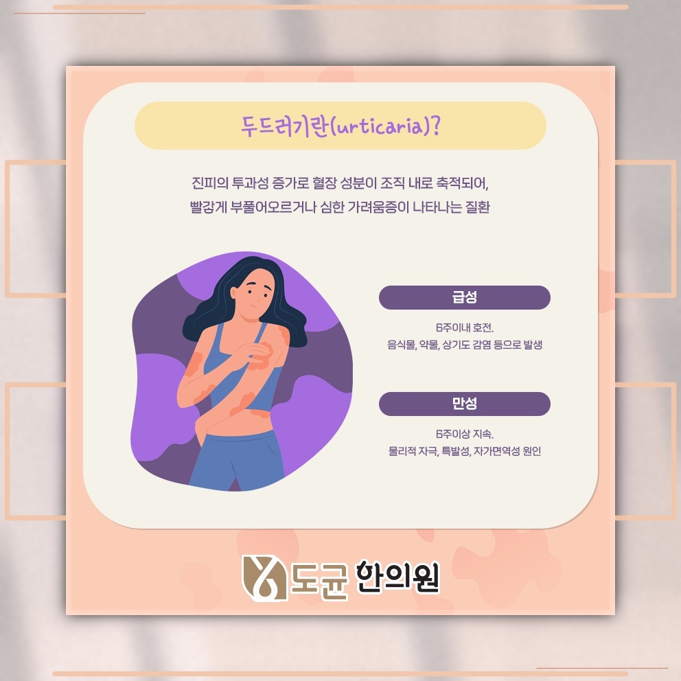 뚜렷한 원인 없이 이어지는 만성 두드러기, 관리의 방향