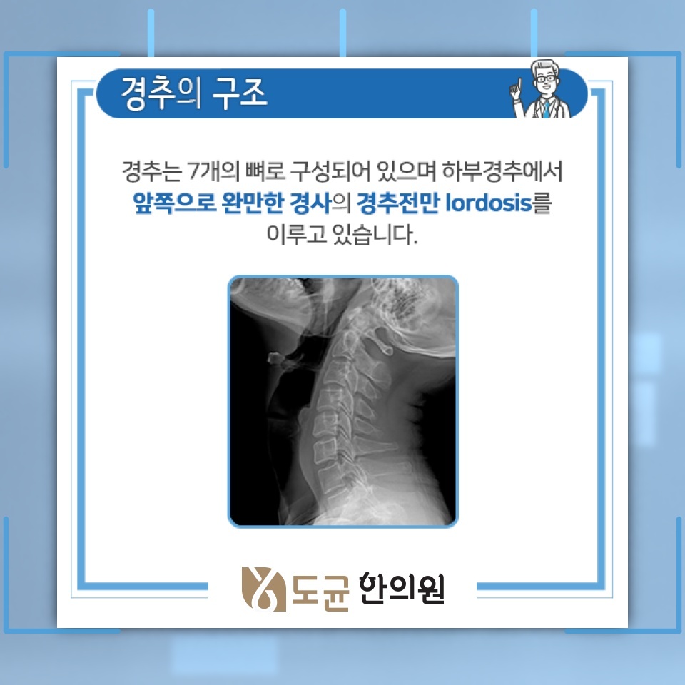 거북목증후군에서 나타나는 목 결림과 두통의 연관성